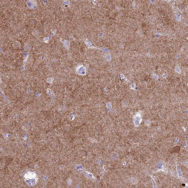 PDE10A Antibody in Immunohistochemistry (Paraffin) (IHC (P))