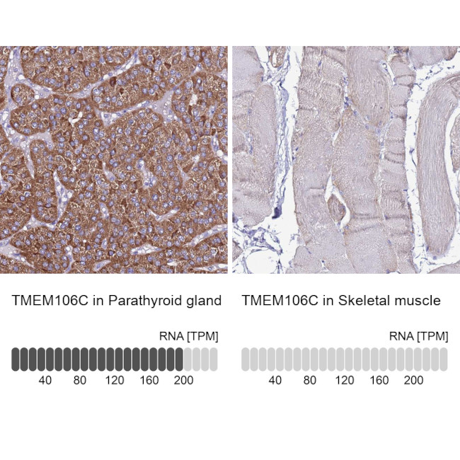 TMEM106C Antibody in Immunohistochemistry (IHC)