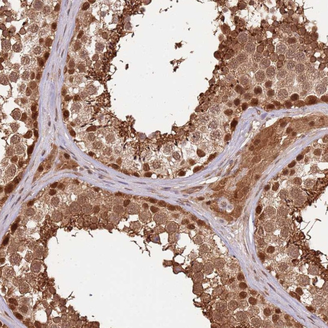 PLSCR5 Antibody in Immunohistochemistry (Paraffin) (IHC (P))