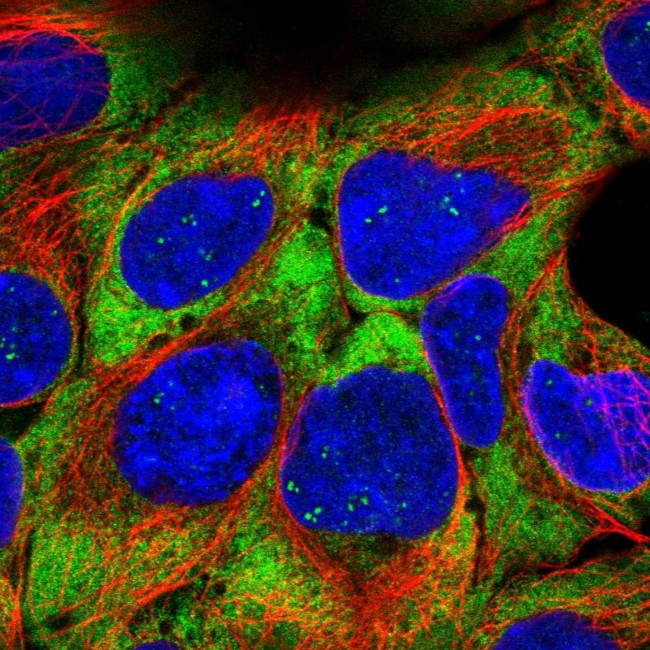 RPL21 Antibody in Immunocytochemistry (ICC/IF)