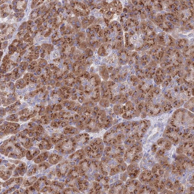 RM30 Antibody in Immunohistochemistry (Paraffin) (IHC (P))