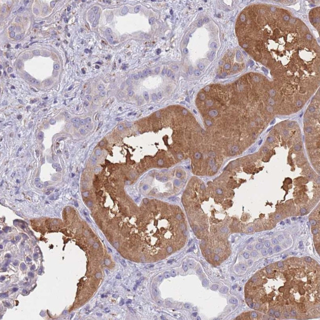 OR7C2 Antibody in Immunohistochemistry (Paraffin) (IHC (P))