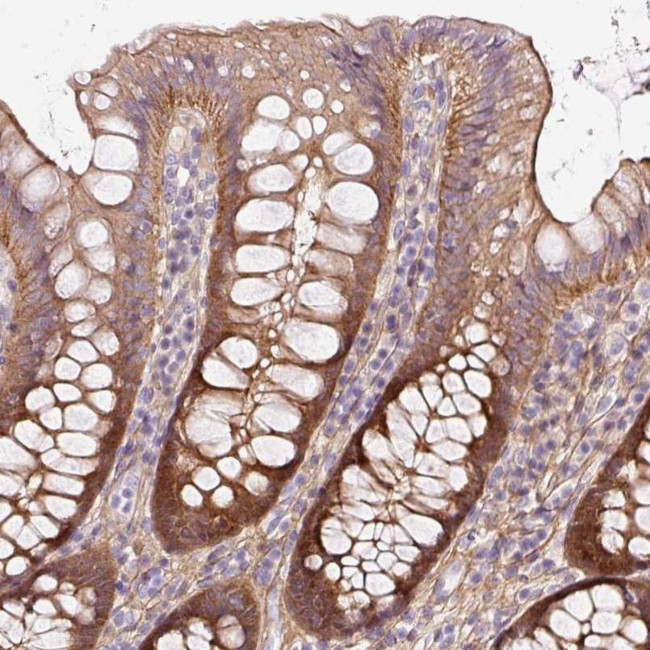 SOS2 Antibody in Immunohistochemistry (IHC)