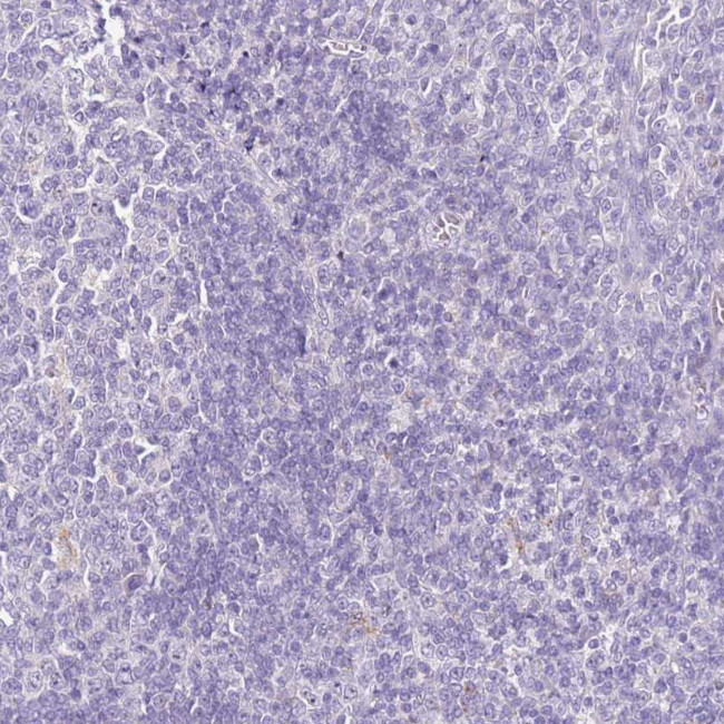 HGD Antibody in Immunohistochemistry (Paraffin) (IHC (P))