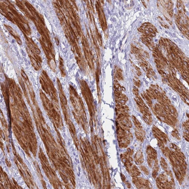 KBTBD3 Antibody in Immunohistochemistry (Paraffin) (IHC (P))