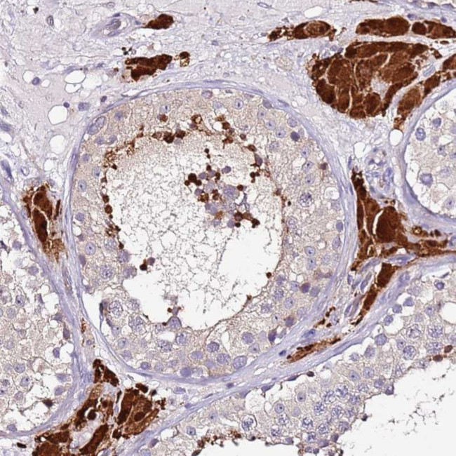 SRRM5 Antibody in Immunohistochemistry (Paraffin) (IHC (P))