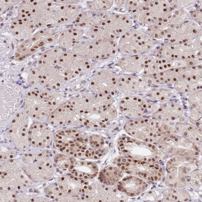 SLC25A32 Antibody in Immunohistochemistry (Paraffin) (IHC (P))