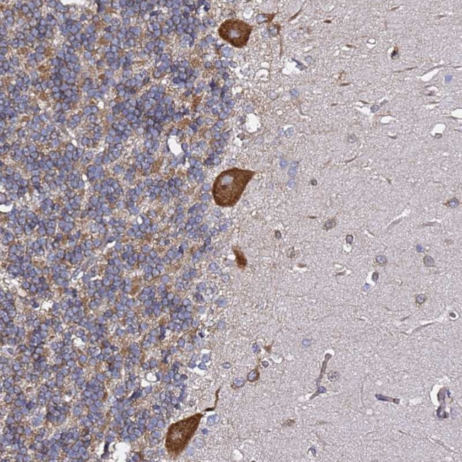 TPST1 Antibody in Immunohistochemistry (Paraffin) (IHC (P))
