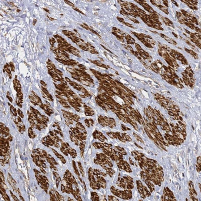TIS11D Antibody in Immunohistochemistry (IHC)