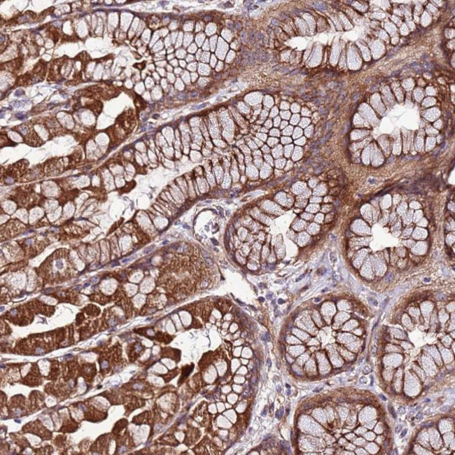 TOPAZ1 Antibody in Immunohistochemistry (Paraffin) (IHC (P))
