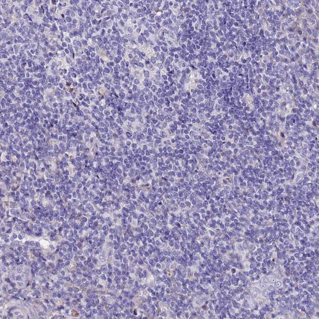 C3orf80 Antibody in Immunohistochemistry (Paraffin) (IHC (P))