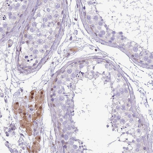 NBPF6 Antibody in Immunohistochemistry (Paraffin) (IHC (P))