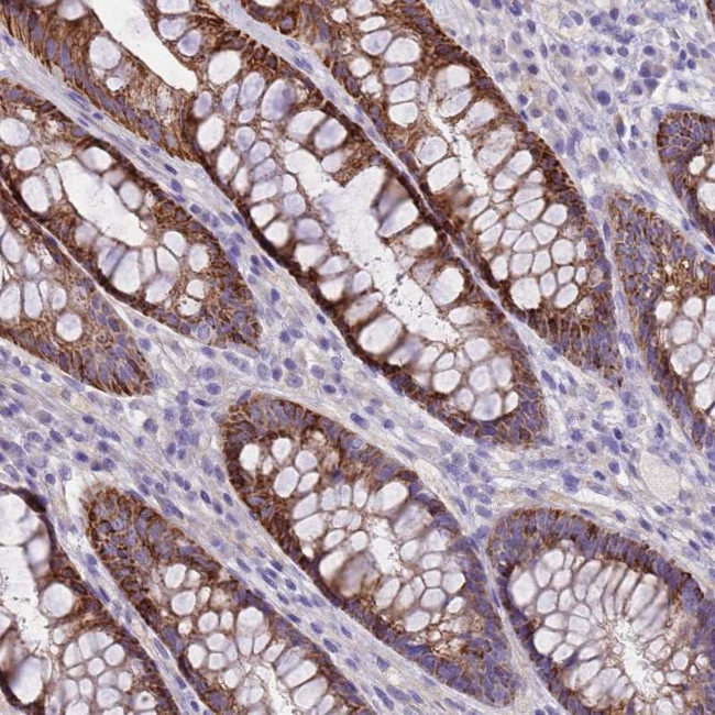 RIPPLY2 Antibody in Immunohistochemistry (Paraffin) (IHC (P))