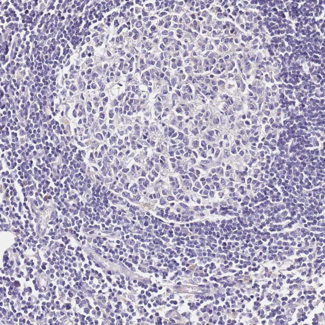 OR2B11 Antibody in Immunohistochemistry (Paraffin) (IHC (P))