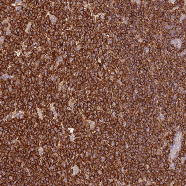 OR6P1 Antibody in Immunohistochemistry (Paraffin) (IHC (P))