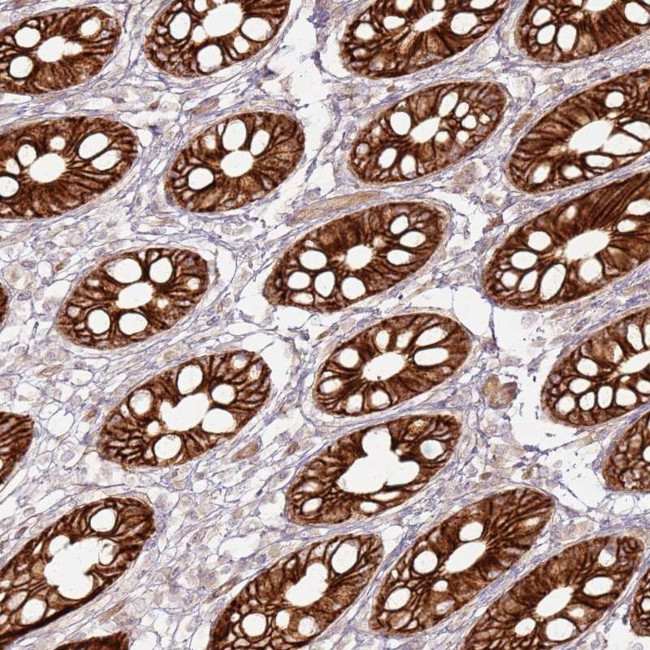TLDC2 Antibody in Immunohistochemistry (Paraffin) (IHC (P))