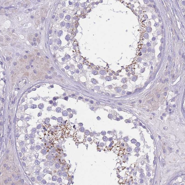 PDHA2 Antibody in Immunohistochemistry (Paraffin) (IHC (P))