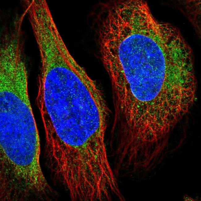 VRK2 Antibody in Immunocytochemistry (ICC/IF)