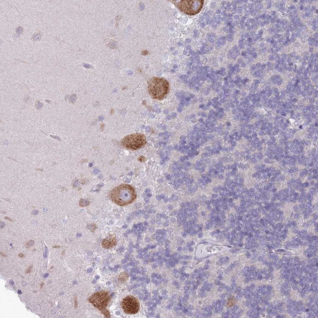OR5L1/OR5L2 Antibody in Immunohistochemistry (Paraffin) (IHC (P))