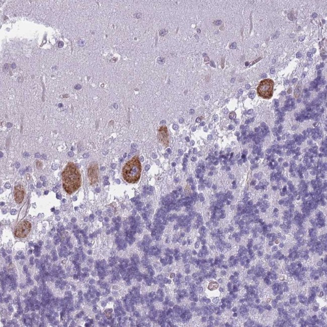OR6B2 Antibody in Immunohistochemistry (Paraffin) (IHC (P))