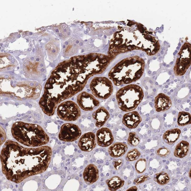 GGT2 Antibody in Immunohistochemistry (Paraffin) (IHC (P))