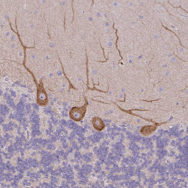 MYH10 Antibody in Immunohistochemistry (IHC)