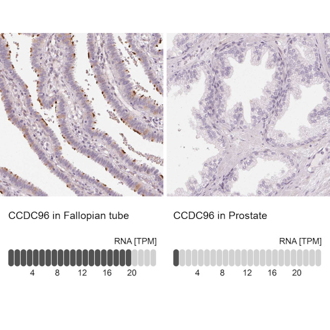 CCDC96 Antibody in Immunohistochemistry (IHC)