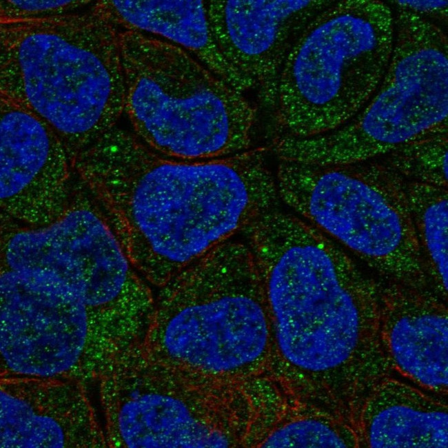 Cytochrome B5 Antibody in Immunocytochemistry (ICC/IF)