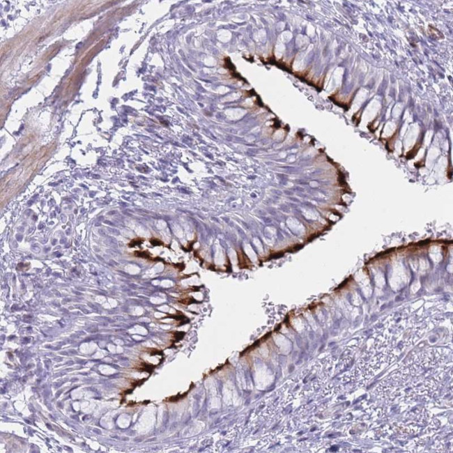 Interferon alpha-6 Antibody in Immunohistochemistry (Paraffin) (IHC (P))