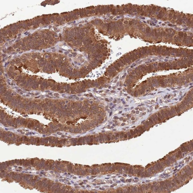 LRRC43 Antibody in Immunohistochemistry (Paraffin) (IHC (P))