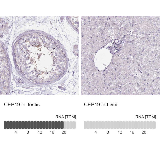 CEP19 Antibody in Immunohistochemistry (IHC)