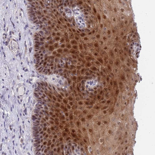 PLCL2 Antibody in Immunohistochemistry (Paraffin) (IHC (P))