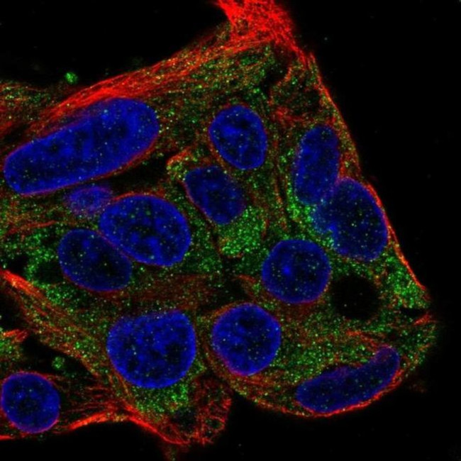 FBXL22 Antibody in Immunocytochemistry (ICC/IF)