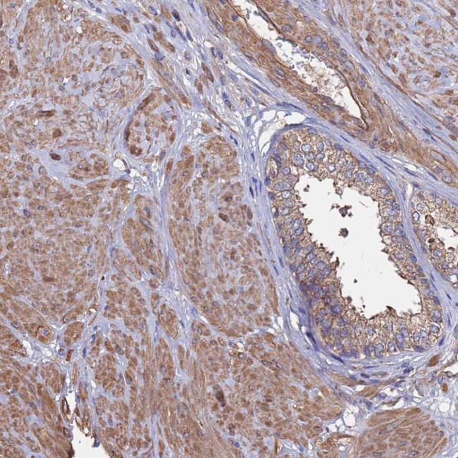 PYCR1 Antibody in Immunohistochemistry (Paraffin) (IHC (P))