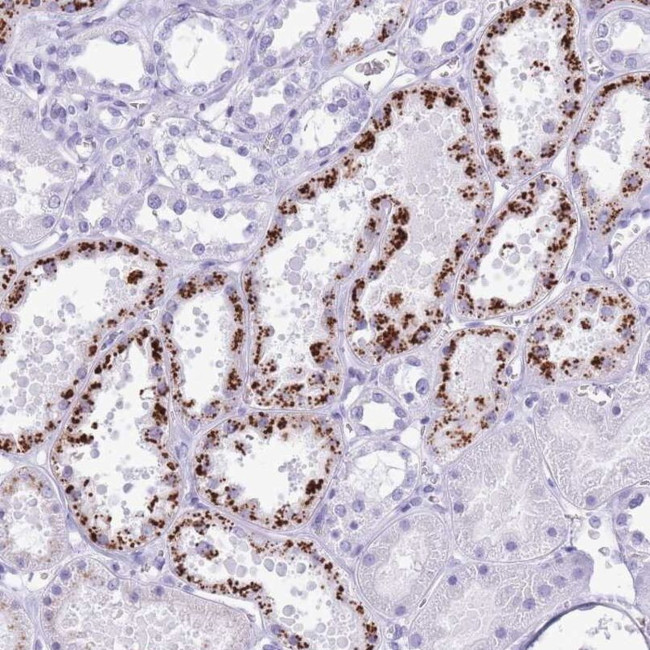 OR4F3 Antibody in Immunohistochemistry (IHC)