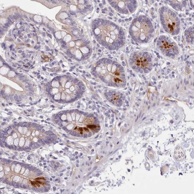 ZNF658 Antibody in Immunohistochemistry (Paraffin) (IHC (P))