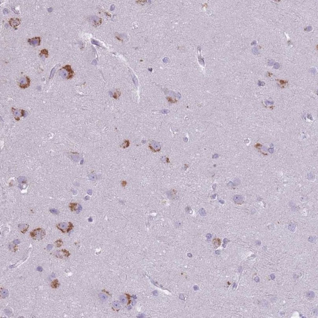 CNTNAP3 Antibody in Immunohistochemistry (IHC)