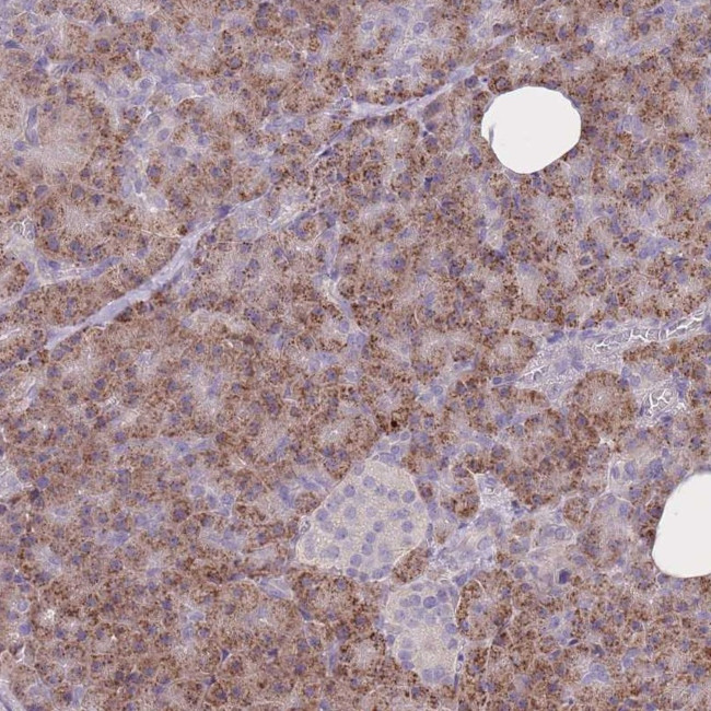 FRG2 Antibody in Immunohistochemistry (Paraffin) (IHC (P))