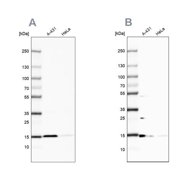 CCDC58 Antibody in Western Blot (WB)