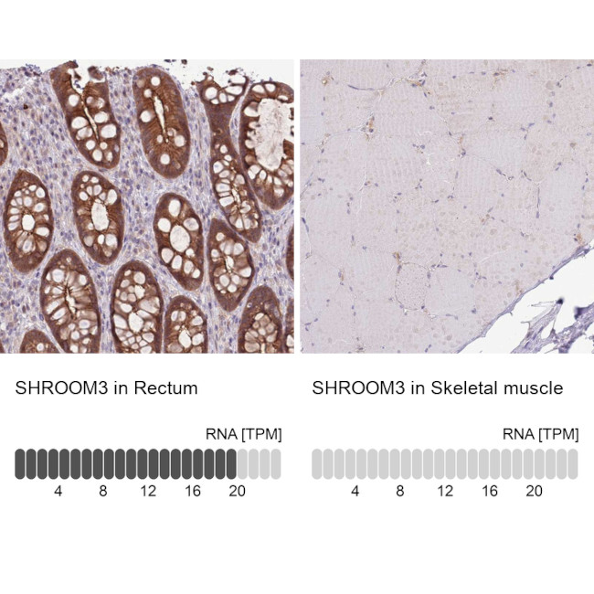 SHROOM3 Antibody
