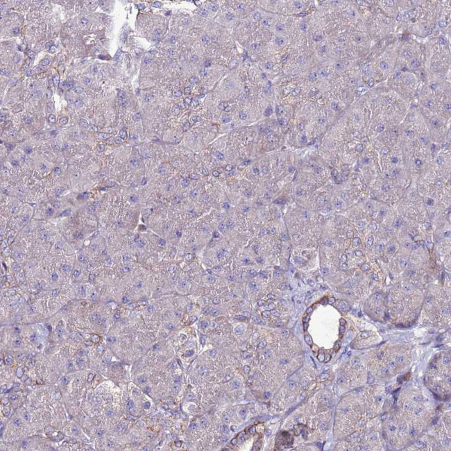 GPN3 Antibody in Immunohistochemistry (Paraffin) (IHC (P))