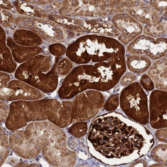 SMCO3 Antibody in Immunohistochemistry (Paraffin) (IHC (P))