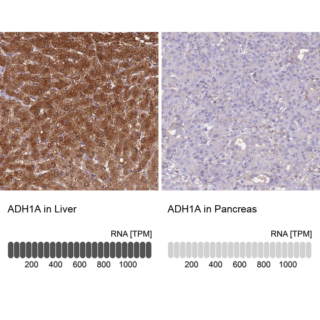 Alcohol Dehydrogenase 1A Antibody in Immunohistochemistry (Paraffin) (IHC (P))