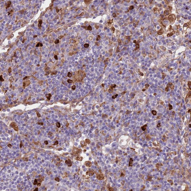 COLGALT1 Antibody in Immunohistochemistry (Paraffin) (IHC (P))