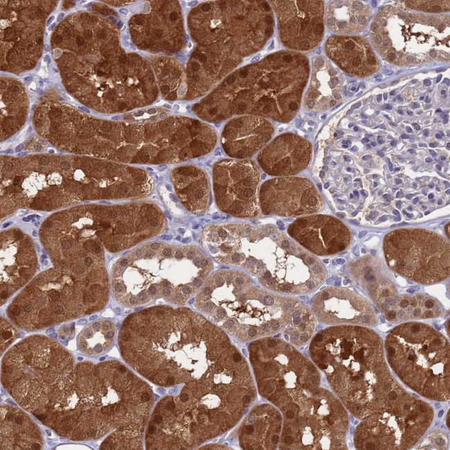 ENOSF1 Antibody in Immunohistochemistry (Paraffin) (IHC (P))