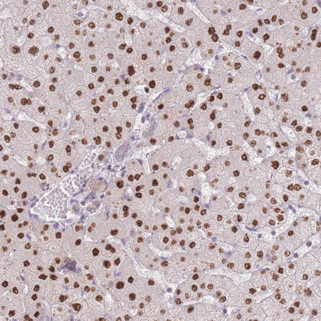ZNF439 Antibody in Immunohistochemistry (Paraffin) (IHC (P))