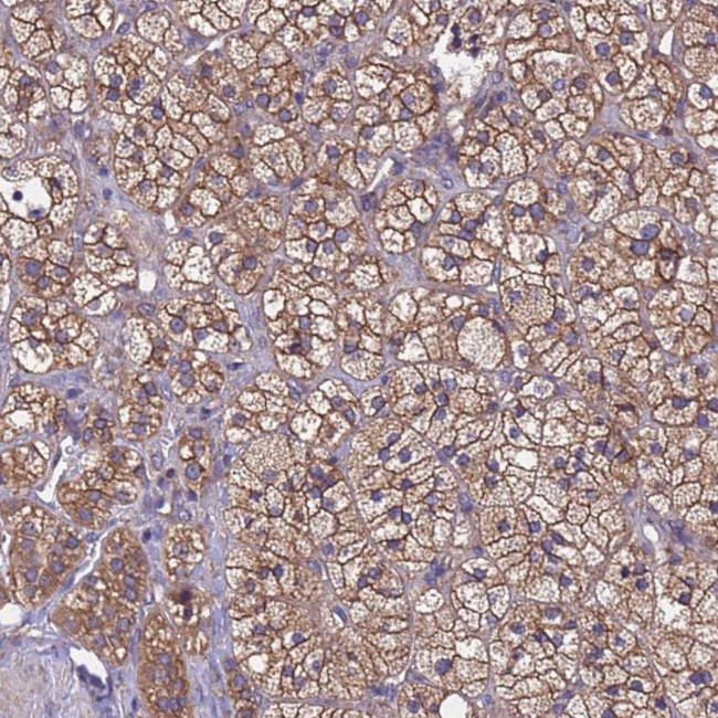 MTX3 Antibody in Immunohistochemistry (Paraffin) (IHC (P))