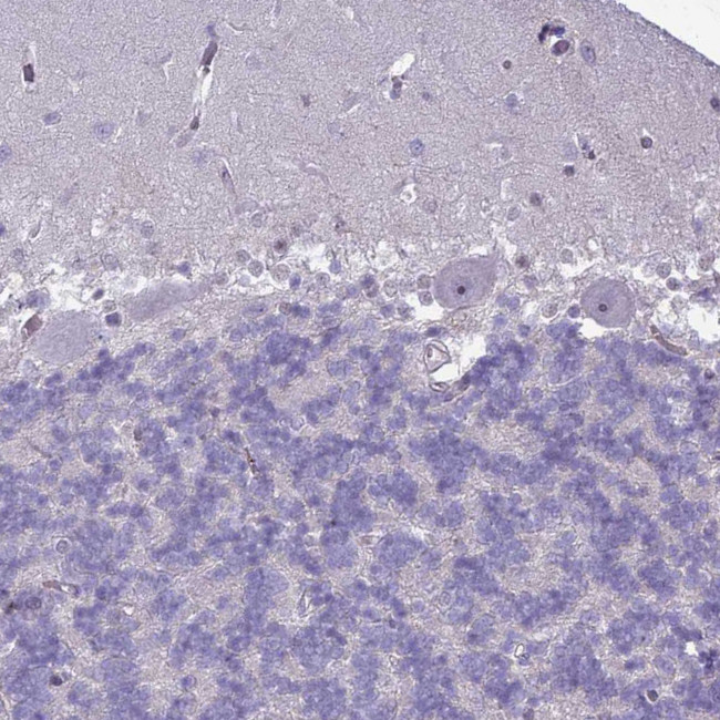 SLC15A3 Antibody in Immunohistochemistry (Paraffin) (IHC (P))