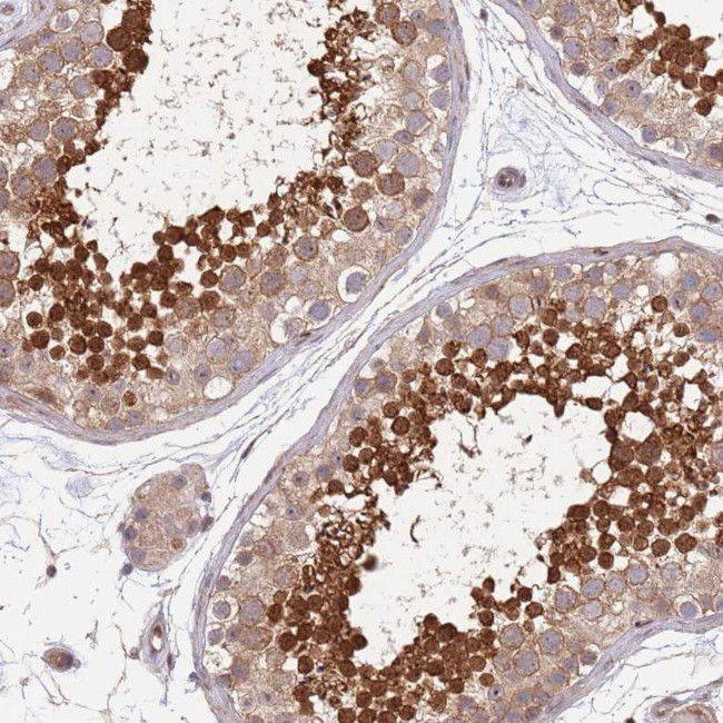 TBX10 Antibody in Immunohistochemistry (Paraffin) (IHC (P))