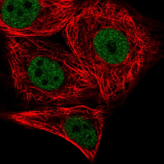 PATZ1 Antibody in Immunocytochemistry (ICC/IF)